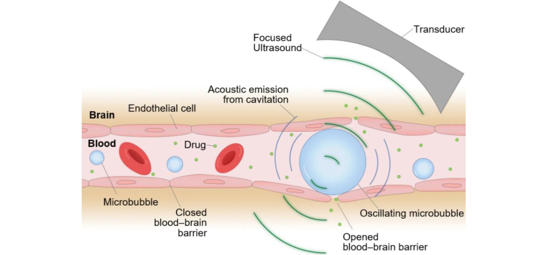 curix-blood-vessel-microbubbles-wide